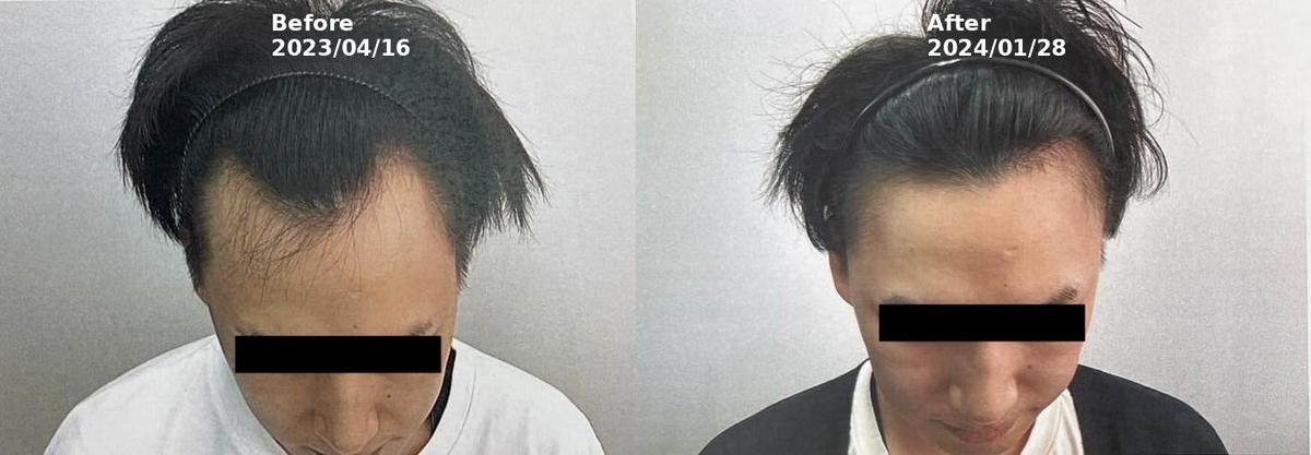 服薬治療の経過